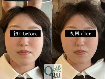 キュープ 福岡天神店(Qpu)の写真/オールハンド施術で痛みのないじんわり指圧◎たった２０分、お顔の左右差、もたつき、凝りがスッキリ◎