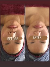 小顔コルギサロン シー(She)/【コルギ】1度の変化!