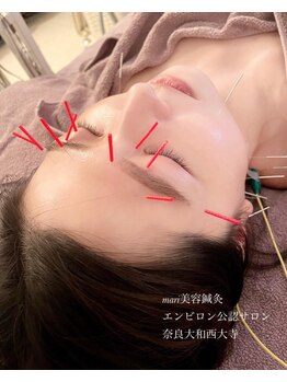 マリ美容鍼灸(mari美容鍼灸)/東大式鍼灸＆美容鍼灸★