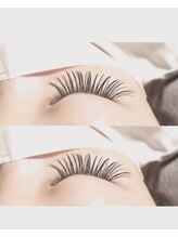 ベルアイズ(Belle eyes)/【ＬＥＤエクステ】バインド