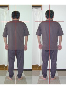 ピュアリー整療院/施術前後（後ろ）