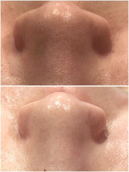 レヴ 都城店(rev)/ララピール