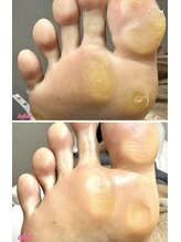 ラヴィ(La vie)/靴のサイズ変わった？