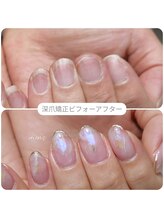 ミンスネイル(Mins Nail)/美爪になれる
