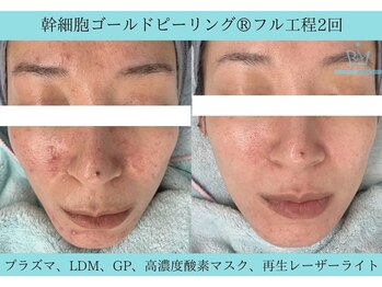 リメイク 広尾(REMAKE)/