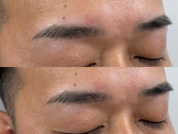 ソリン(Solin')/メンズ眉ワックス脱毛