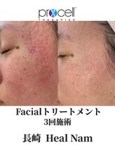 ヒルナム(Heal Nam)/プロセルセラピーズ~フェイス~