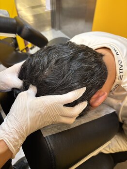 ファスト整体スタンドチャージ 栄森の地下街店/頭ほぐし