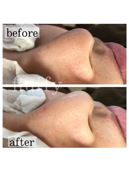 フラフィ 宇都宮本店(fluffy)/一見綺麗に見えても(＞人＜;)