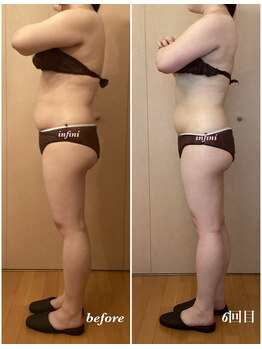 アンフィニ(infini)/短期集中コース6回目(2ヶ月)