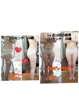 フレクシー/Aコース10回痩身３か月の結果　