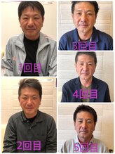 長寿鍼灸院 長寿整骨院/men's美容鍼ハリネズミコース★