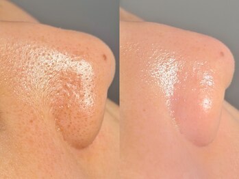 ルーナジェーナ(Luna llena)/池袋　エステ　ルーナジェーナ