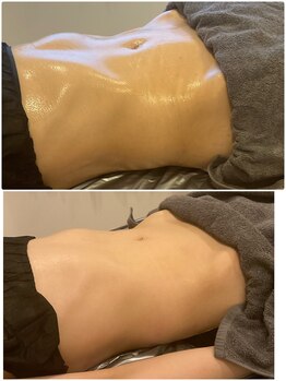 ウル(Ulu)/腸もみビフォーアフター