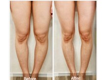 リアン(Lien)/before after