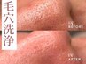 【いちご鼻改善】頑固な詰まり！ 毛穴洗浄(Tゾーン) クイックコース