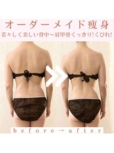 トータルビューティージュネス(JEUNESSE)/50代/年齢は背中に現れます！