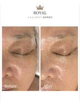 ロイヤル(ROYAL)/トロイピール