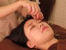 【カウンセリング付】小顔美容鍼!肌トラブルも一緒に徹底改善☆10,000→5,000