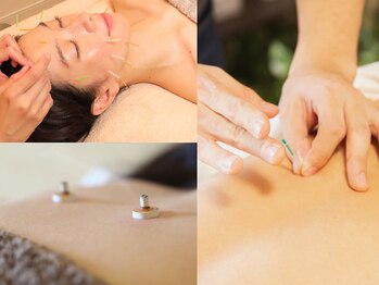 鍼とよもぎ。の写真/肩こり・腰痛・自律神経の乱れ・慢性疲労に。痛みやゆらぎの原因にしっかりアプローチする本格鍼灸。