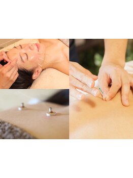 鍼灸施術を受けたい