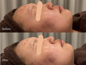 アウラ 小杉店(AULA)/