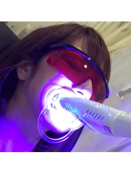 ポラリス(Polaris)/セルフホワイトニング