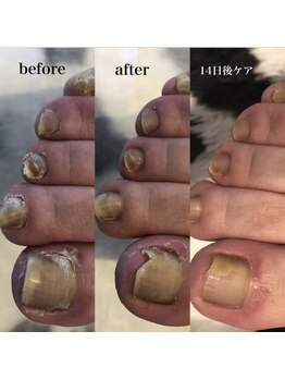 シャルム ド ケー(charme de k)/極上足裏角質ケア