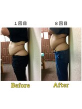 マリモ鍼灸接骨院/電磁パルス週1回　8回目の結果