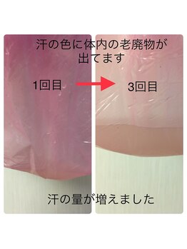 ラフ(laugh)/連続3日発汗コース後の汗