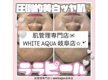 ホワイトアクア 岐阜店(WHITE AQUA)/ララピール/岐阜/毛穴