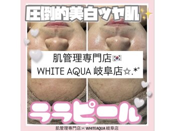 ホワイトアクア 岐阜店(WHITE AQUA)/ララピール/岐阜/毛穴