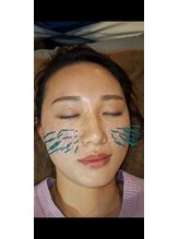 ほぐし堂/リガメント靱帯改善鍼