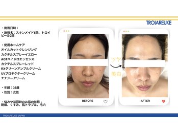 リトルーム(Litroom: from Seoul)/スキンメイド