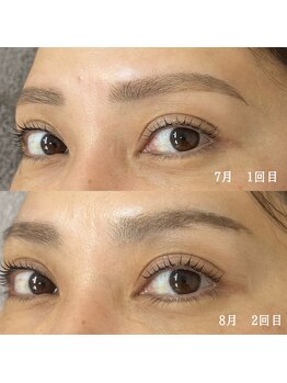 ランプ(LAMP)/効果大！マイラミネーション