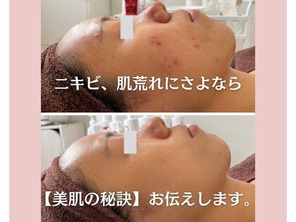 ファシル(Facile)の写真