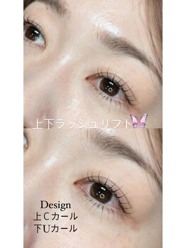 キャンディベース ノースアップ(Candybase North up)/上下ラッシュリフト