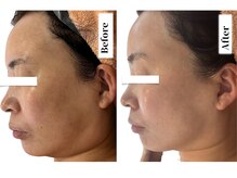 ベル(BeL)/フェイシャル