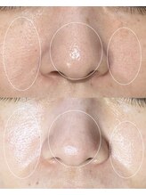 ソワ 吉塚店(soi)/年齢なんて関係なし♪