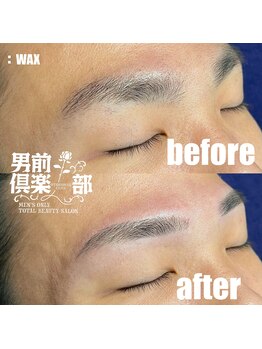 男前倶楽部/脱毛/メンズ脱毛/メンズ専門店