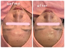 ヒメミ(Himemi)/艶肌Ｗａｘ