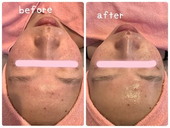 ヒメミ(Himemi)/艶肌Wax