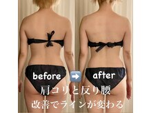 サロン ド プリヴェ(Salon de PRIVE)の雰囲気（痩身/首もっこり/肩の盛り上がり/埋もれた首/ラインを変える）