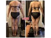 エステティックサロン リアン(Lien)/上半身痩せのお客様