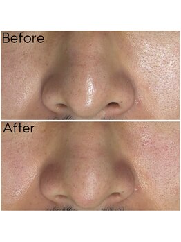 カシェボーテ(CACHE BEAUTE)/