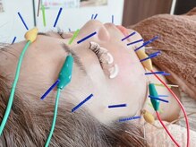 レフアうめじま整骨院