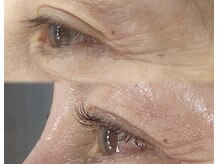 ビキャット(Be cat)/人気！韓国マンゴーロット