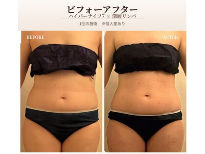 ナースのロミリンパの写真