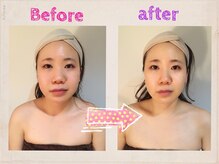 イーフェイス(e face)/フェイスビートダンス