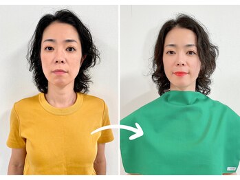 エピファニー 東京 銀座/ビフォーアフター(A.H様 40代)